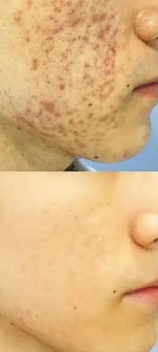 ほわいと あざぶのマツエク・マツパデザイン