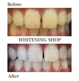 ホワイトニングショップ静岡葵区店所属・ホワイトニング ショップ葵区静岡駅店のその他イメージ