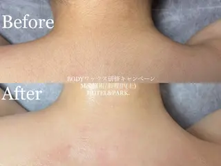 HOTEL&PARK . ワックス脱毛のエステ・リラクイメージ
