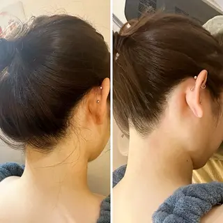 うなじ脱毛/美肌脱毛 LABELのエステ・リラクイメージ