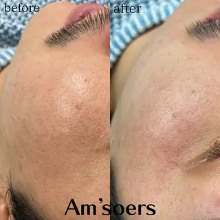 Am'soers 本橋のエステ・リラクイメージ