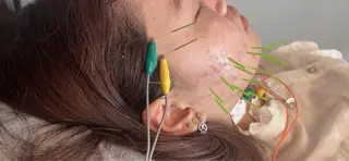 はりきゅう    SieL所属・内田 有紀のエステ・リラクイメージ