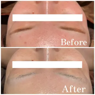 Folche所属・Folcheはません 森山のエステ・リラクイメージ