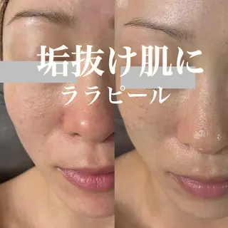 WHITE AQUA 北千住店のエステ・リラクイメージ