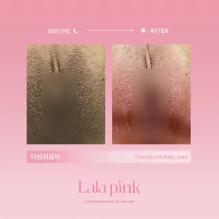 KIRAN 山﨑のエステ・リラクイメージ