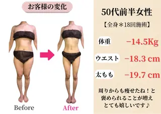 Belle White所属・本格痩身＊肌質改善＊ BelleWhiteのエステ・リラクイメージ