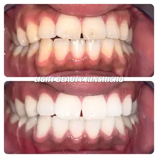 メンズ ライトビューティー 錦糸町店のエステ・リラクイメージ