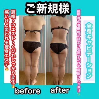 痩身/脱毛/ネイル HARUKAのエステ・リラクイメージ