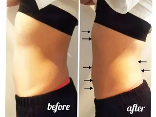 【ニキビ/肌管理】 salon varyのエステ・リラクイメージ