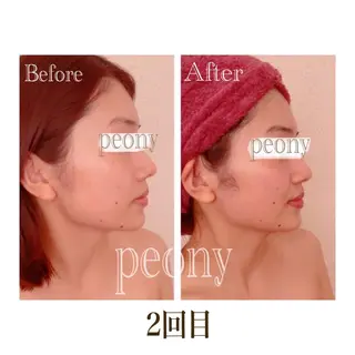 デトックス美容専門サロンｐｅｏｎｙ所属・デトックス美容専門 サロンｐｅｏｎｙのエステ・リラクイメージ