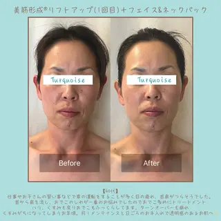 フェイシャルエステ Turquoiseのエステ・リラクイメージ