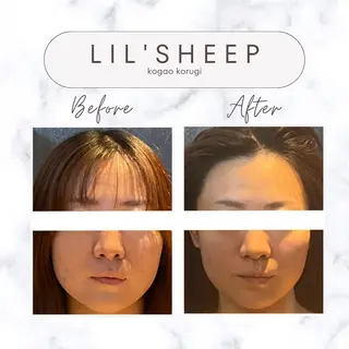 小嶋萌 今池駅徒歩2分のエステ・リラクイメージ