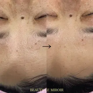 ビューティー ミロワールのエステ・リラクイメージ