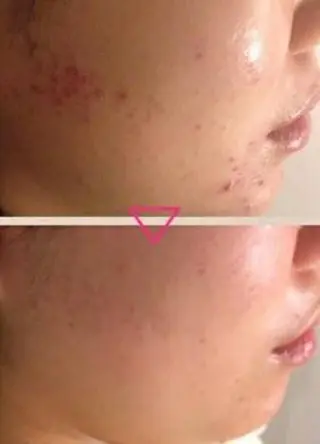 痩身リンパダイエット 隠れ家サロンチャームのエステ・リラクイメージ