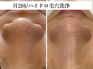 TRINIENCE 南流山店のエステ・リラクイメージ