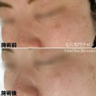 毛穴ケア専門サロン Amélio Beauté所属・毛穴ケア専門サロン アメリオボーテのその他イメージ