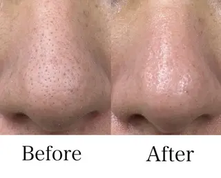 Linoas所属・kogao&head Linoasのその他イメージ