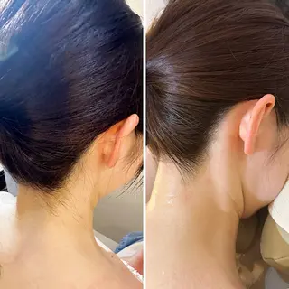 うなじ脱毛/美肌脱毛 LABELのエステ・リラクイメージ