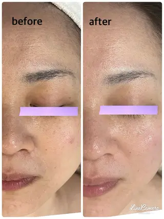 De I'm 名古屋栄店所属・原 いず美のエステ・リラクイメージ