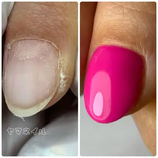 ネイル ネイル&毛穴洗浄 ヤマネイル 山根のネイルデザイン