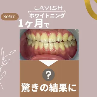 LAVISH nail salonのネイルデザイン