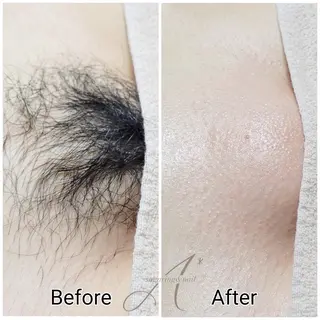 【A*エースター】 KARINのエステ・リラクイメージ