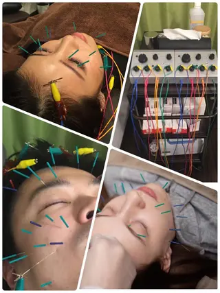 表参道鍼灸院K 美容鍼🔮ララピールのエステ・リラクイメージ