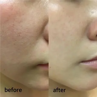 脱毛・眉毛・フェイス サロンN久留米店の眉毛・アイブロウイメージ