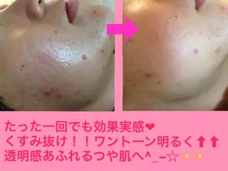 痩身リンパダイエット 隠れ家サロンチャームのエステ・リラクイメージ