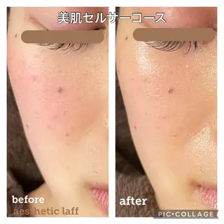 aesthetic laff所属・美肌作りのサロン 山村亜美のエステ・リラクイメージ