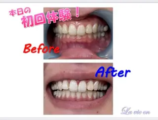 セルフホワイトニングサロン　ラヴィアン所属・ホワイトニングサロン La vie enのその他イメージ