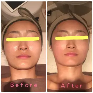 韓国コルギ ハーブピーリング専門  ALMOND所属・ALMOND yukinaのエステ・リラクイメージ