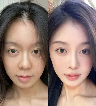 ネイル aliaハイフ&水光ジェットサロン所属・aliaハーブ水光店 エステティシャン募集のエステ・リラクイメージ