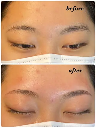 アイブロウ ハーブピーリング/韓国肌管理/フェイシャル/毛穴洗浄/眉毛/顔脱毛【糸脱毛専門】rev所属・ハーブピーリング🌹 毛穴洗浄❤️眉waxのエステ・リラクイメージ