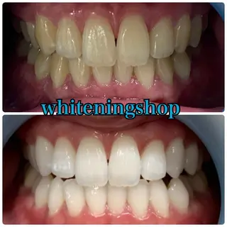 メンズ ホワイトニング ショップ川越店のエステ・リラクイメージ