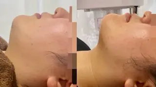 看護師が施術する美容 ナスサロ／小泉のエステ・リラクイメージ