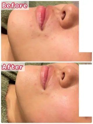 ハーブピーリング専門 muro.のエステ・リラクイメージ