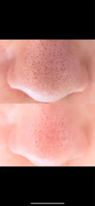 マツエク・マツパ まつ毛エクステ／まつ毛パーマ／フェイシャル／beautysalon cocora所属・ビューティーサロン ココラのマツエク・マツパデザイン