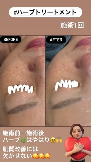 LiZA エステティックサロンのエステ・リラクイメージ