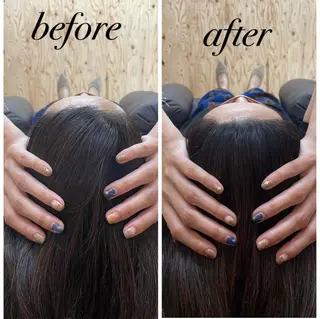 ate'所属・個室ドライヘッドスパ 🍃moriのエステ・リラクイメージ