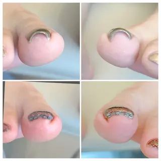 ネイル N port所属・井上 友美のネイルデザイン