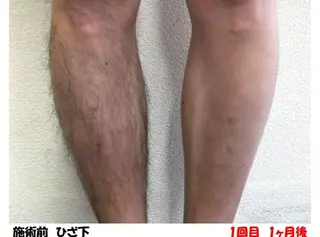 Salon Ree Belle(サロン リベル)所属・サロン リベル YUKAのエステ・リラクイメージ