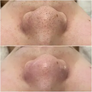 ララ/ハーブ メゾンリュバンのエステ・リラクイメージ