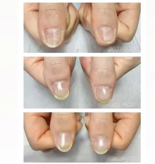 ネイル Sawamoto Akinaのネイルデザイン