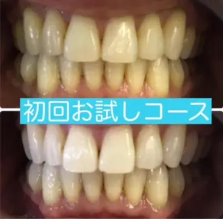 Venus Beauty銀座のマツエク・マツパデザイン