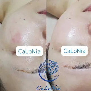 肌質改善・艶髪サロン CaLoNiaのエステ・リラクイメージ