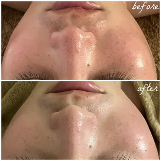 メンズ メナード岐阜茜部 杉浦のエステ・リラクイメージ