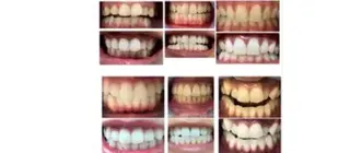 WHITENING ハウスのマツエク・マツパデザイン