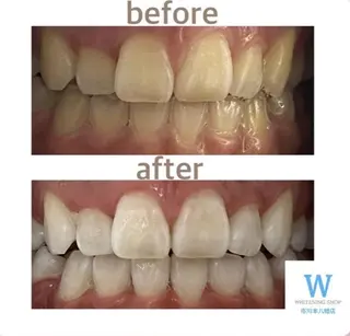 ホワイトニング ショップ本八幡店のエステ・リラクイメージ