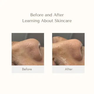 AY'S所属・倉敷/玉島/20代 からの大人毛穴洗浄のエステ・リラクイメージ